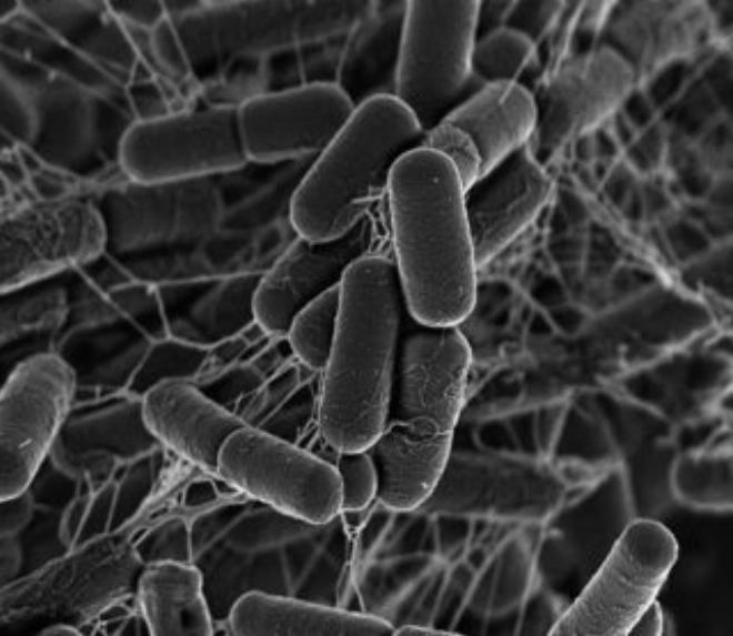Hình ảnh trực quan về các loại vi khuẩn có hại phổ biến như E.coli, Salmonella dưới kính hiển vi
